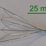Medical Monitoring Inferior Vena Cana Filter