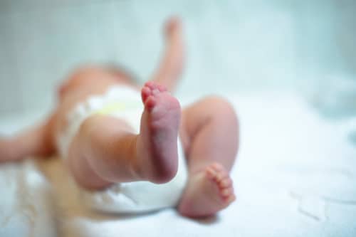 birth injury