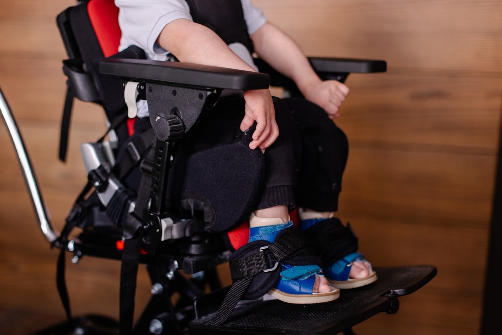 cerebral palsy